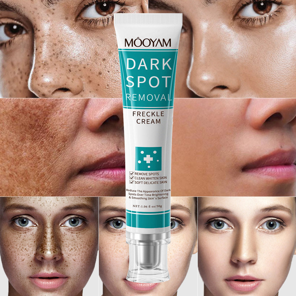 Dark spot removal face cream